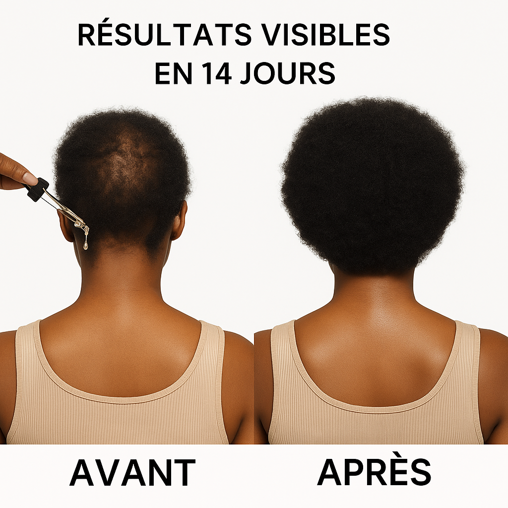 Sérum LovelyCSM Biotin - Pousse rapide et naturelle des cheveux - en 14 jours